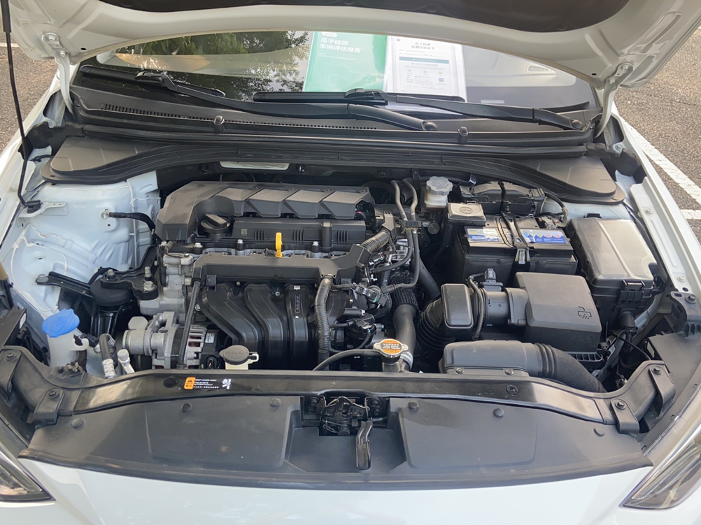 Used Hyundai Elantra 2019 1.5L CVT ZhiXuan – Elite Version
